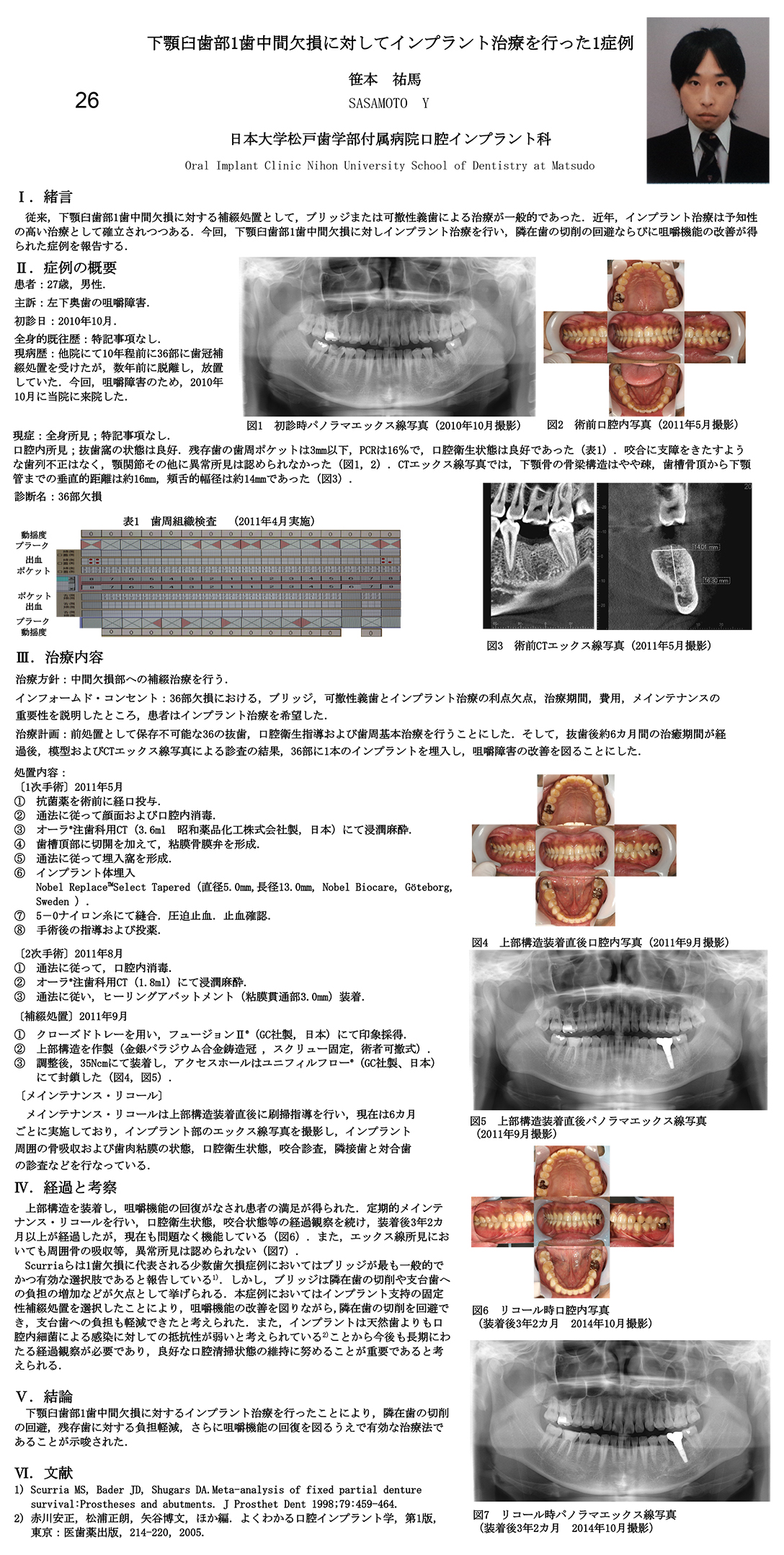 日本口腔インプラント学会論文