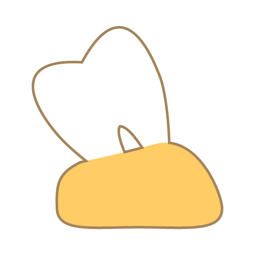歯は抜けたままにしてはいけないの？